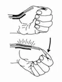 Common Hand Problems 1 Common Elbow Conditions Illustration Showing Tennis Elbow And Golfer’s Elbow Anatomy