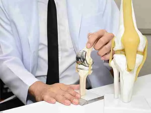 Total Knee Joint Replacement Procedure Image
