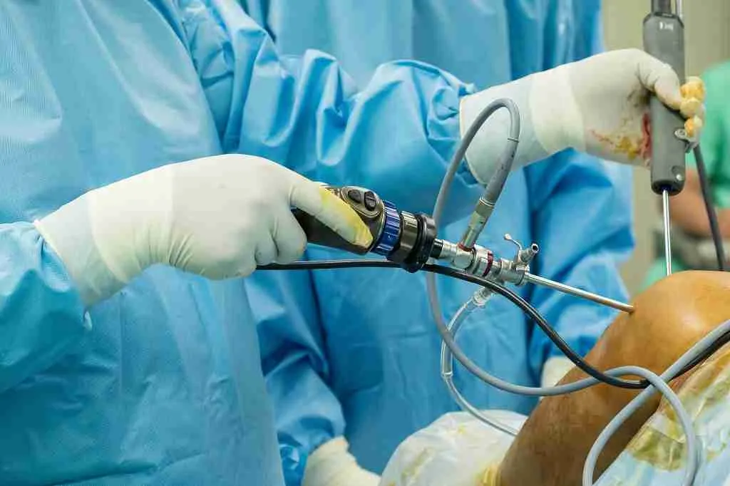 Arthroscopic Surgery 1 Arthroscopic Knee Surgery