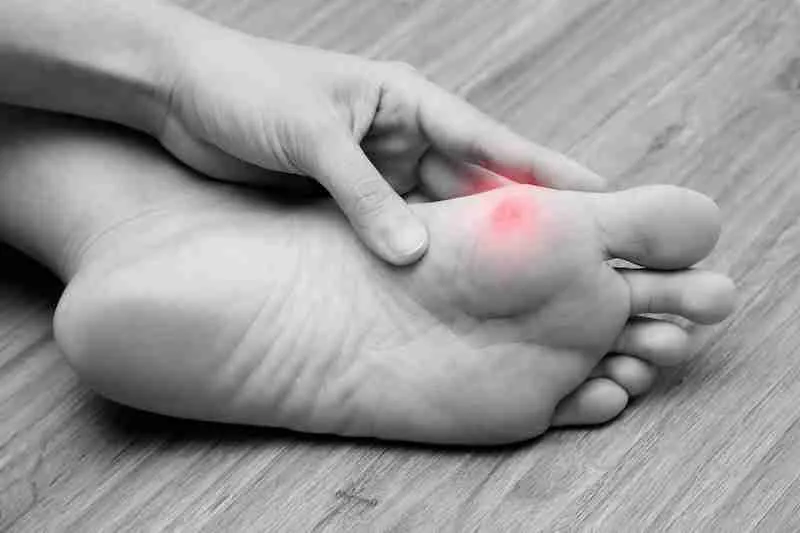 Minimally Invasive Bunion Surgery